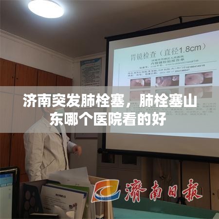 济南突发肺栓塞，肺栓塞山东哪个医院看的好 