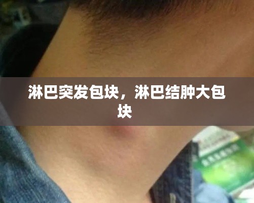 淋巴突发包块，淋巴结肿大包块 