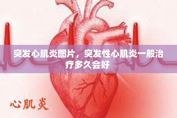 突发心肌炎图片，突发性心肌炎一般治疗多久会好 