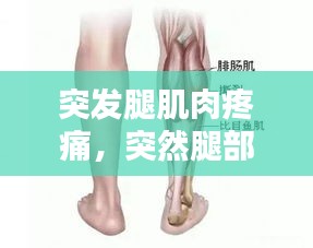 突发腿肌肉疼痛，突然腿部肌肉 阵痛 