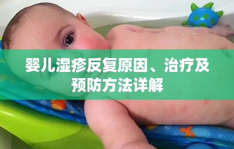 婴儿湿疹反复原因、治疗及预防方法详解