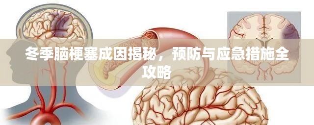 冬季脑梗塞成因揭秘，预防与应急措施全攻略