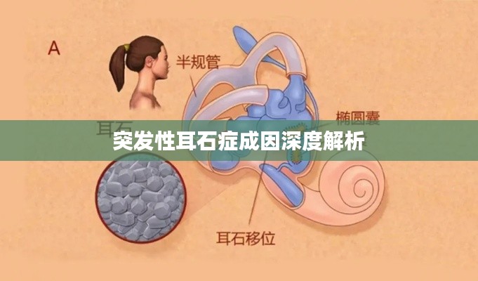 突发性耳石症成因深度解析